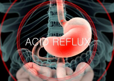 Qué causa el reflujo ácido | Síntomas, desencadenantes y efectos digestivos