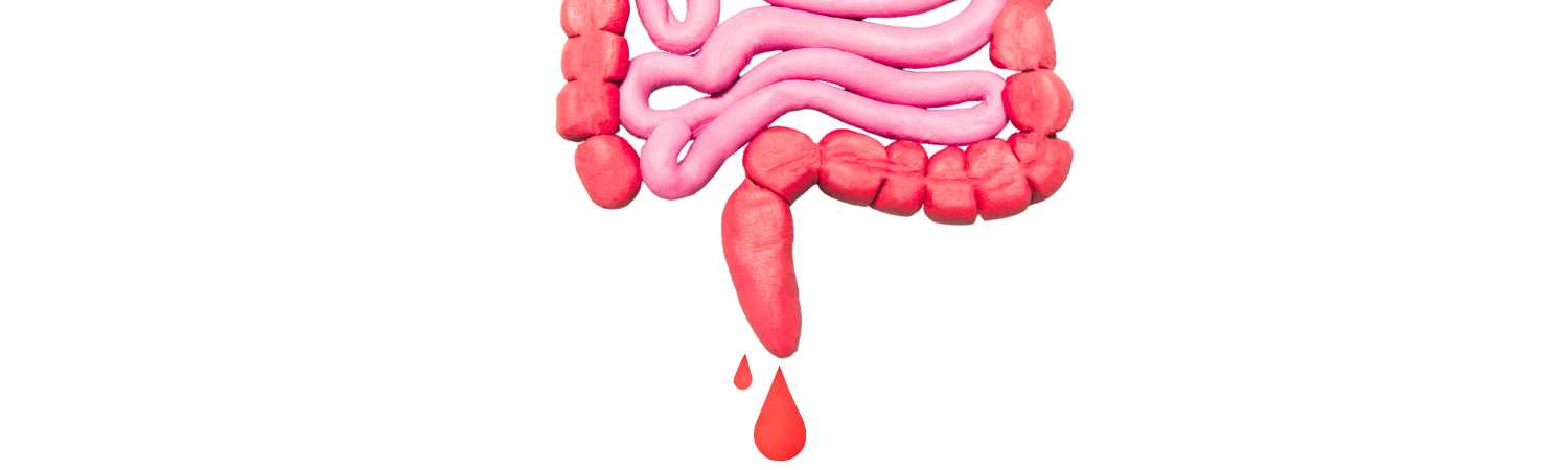 médico experto en gastroenterología cerca de mí para anemia y sangrado gastrointestinal