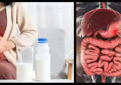 Inflamación del estómago (gastritis)