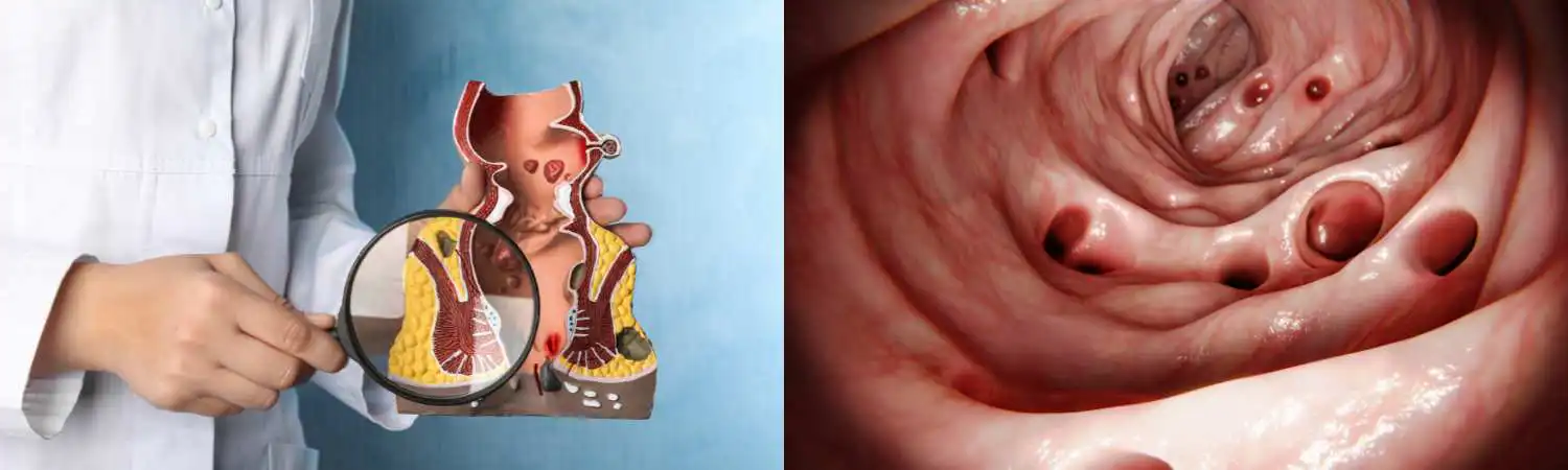 Colonoscopy Services Image 01