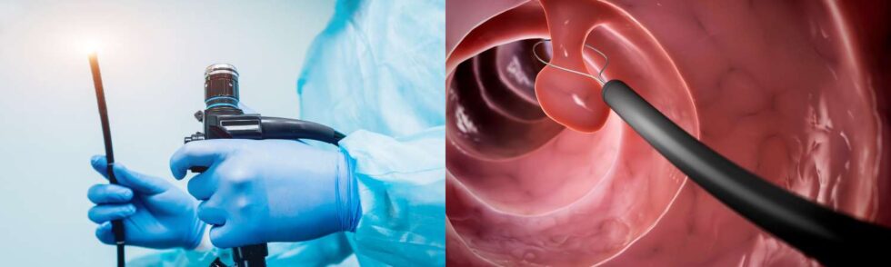 Endoscopy Treatment Houston | Curative Digestive Disease Center