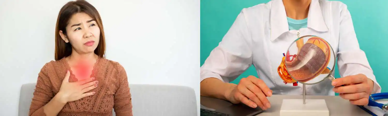 Gastroesophageal Reflux Disease (GERD) Services Image 01