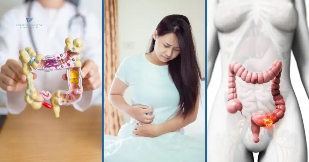 Early detection and treatment of colon cancer in Houston, TX