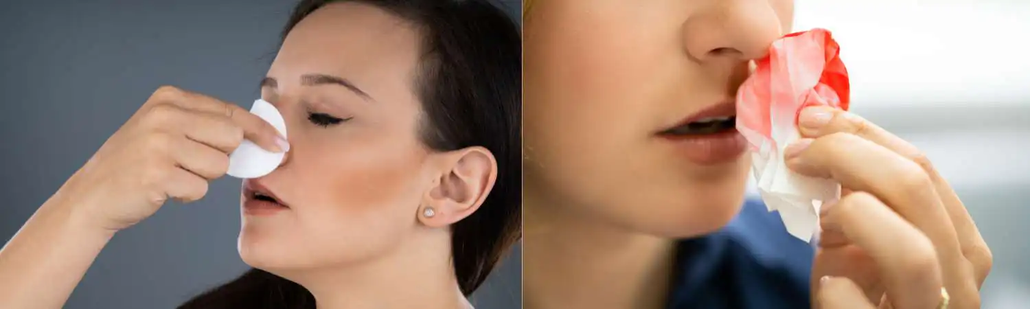 Expert Bleeding and Anemia Treatment in Houston