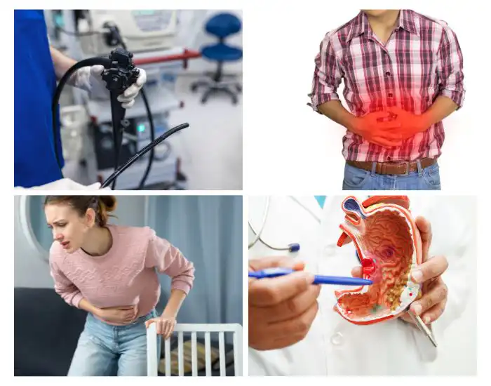 Colonoscopy in Houston, TX at Curative Digestive Disease Center
