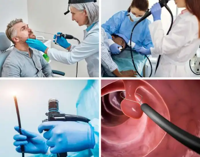Endoscopy Treatment in Houston