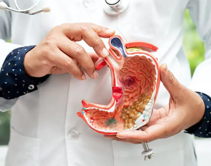 Expert GERD and acid reflux care at Curative Digestive Disease Center in Houston
