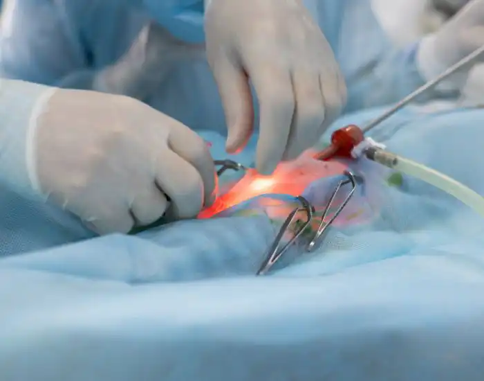 capsule endoscopy Houston