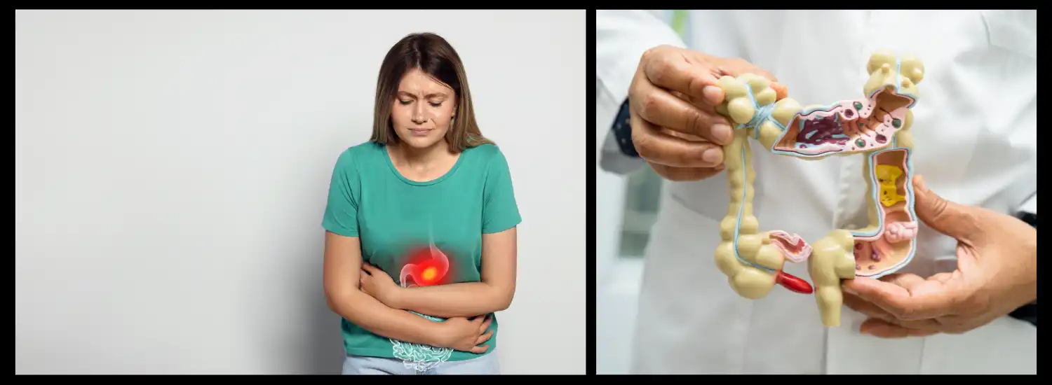 Irritable Gut Syndrome