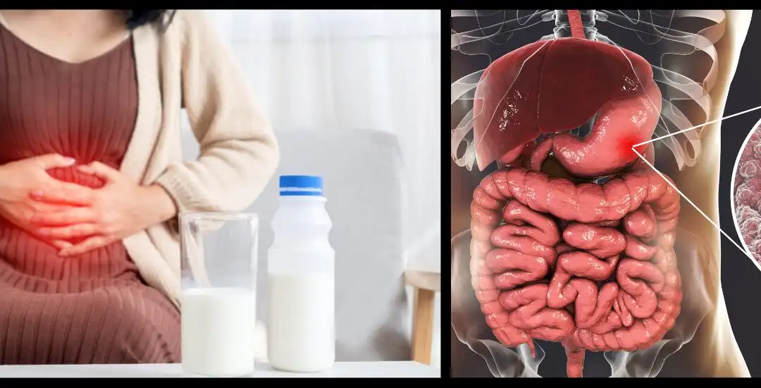 Stomach Inflammation (Gastritis): Causes, Symptoms & When to See a Doctor