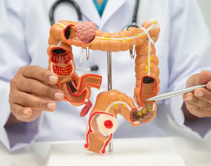 Best gastroenterologist near Bellaire, Houston TX