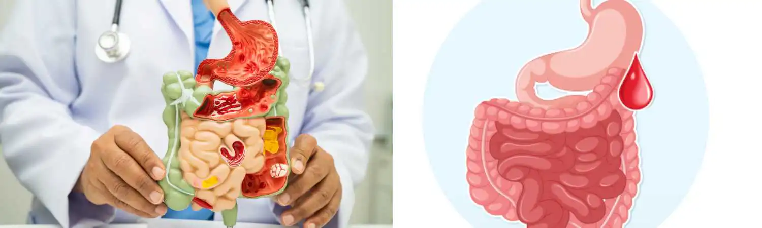 Self-pay digestive care in Houston, TX