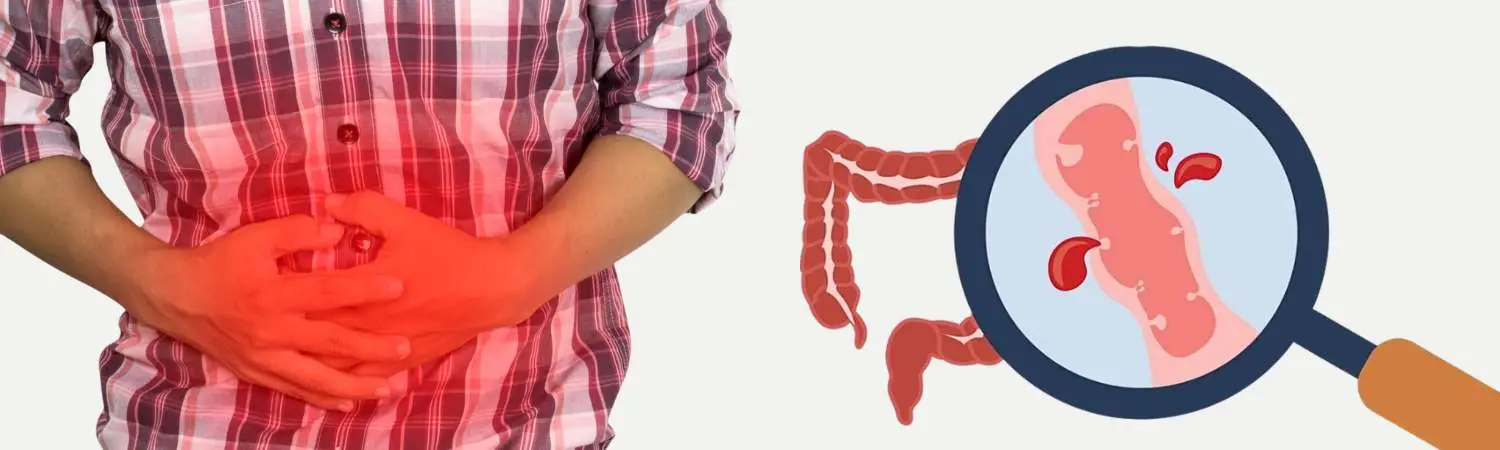 Same-day gastroenterology appointments in Houston, TX