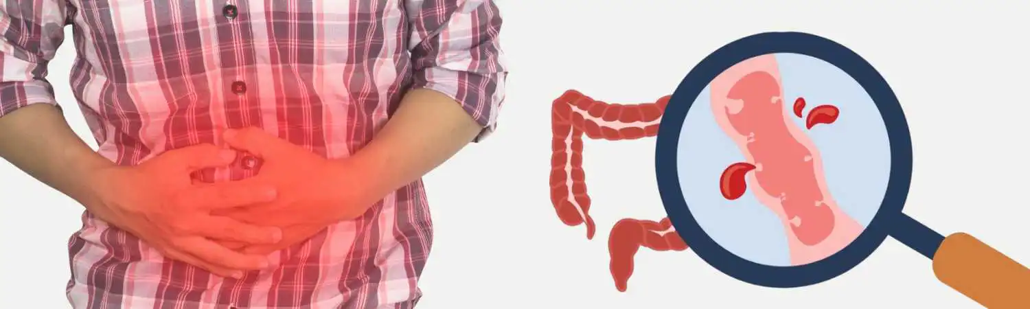 Urgent GI bleeding evaluation in Houston, TX